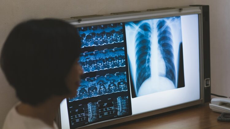 健康被害がおよぶリスク（写真／PIXTA）