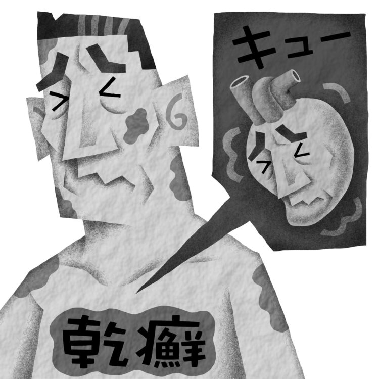 乾癬が心疾患の危険因子であるとの研究報告も（イラスト／いかわやすとし）