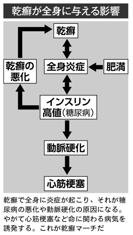 乾癬が全身に与える影響