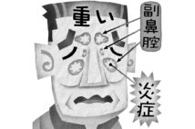 慢性副鼻腔炎の国内患者数は100～200万人いるといわれる（イラスト／いかわやすとし）