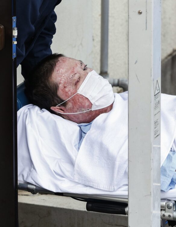 病院に運ばれる青葉被告（写真／共同通信社）