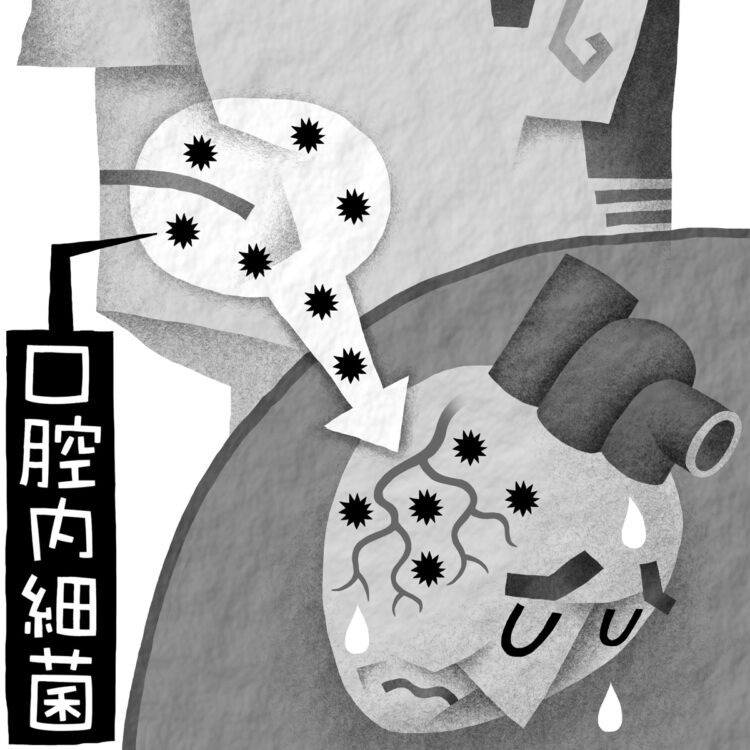 口腔内細菌は虫歯や歯周病の原因となるだけではない（イラスト／いかわやすとし）