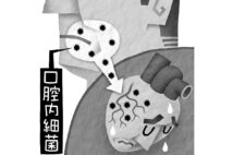 口腔内細菌は虫歯や歯周病の原因となるだけではない（イラスト／いかわやすとし）