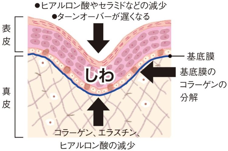 しわができる仕組み