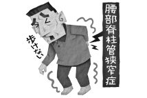 重症の腰部脊柱管狭窄症はどう治療する？（イラスト／いかわやすとし）