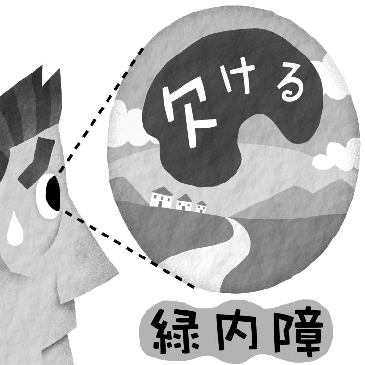 緑内障は40歳代以降で発症リスクが高まるという（イラスト／いかわやすとし）
