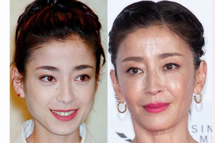 ホクロ除去前の宮沢（左）と除去後の宮沢（右）（時事通信フォト）