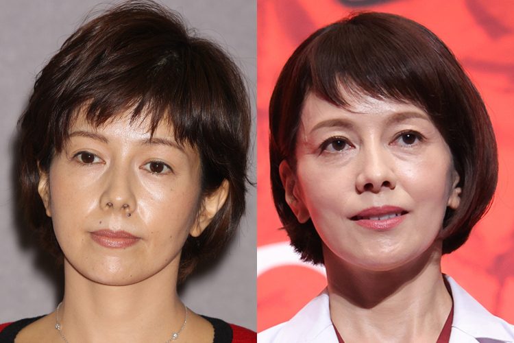 ホクロ除去前の沢口（左）と除去後の沢口（右）