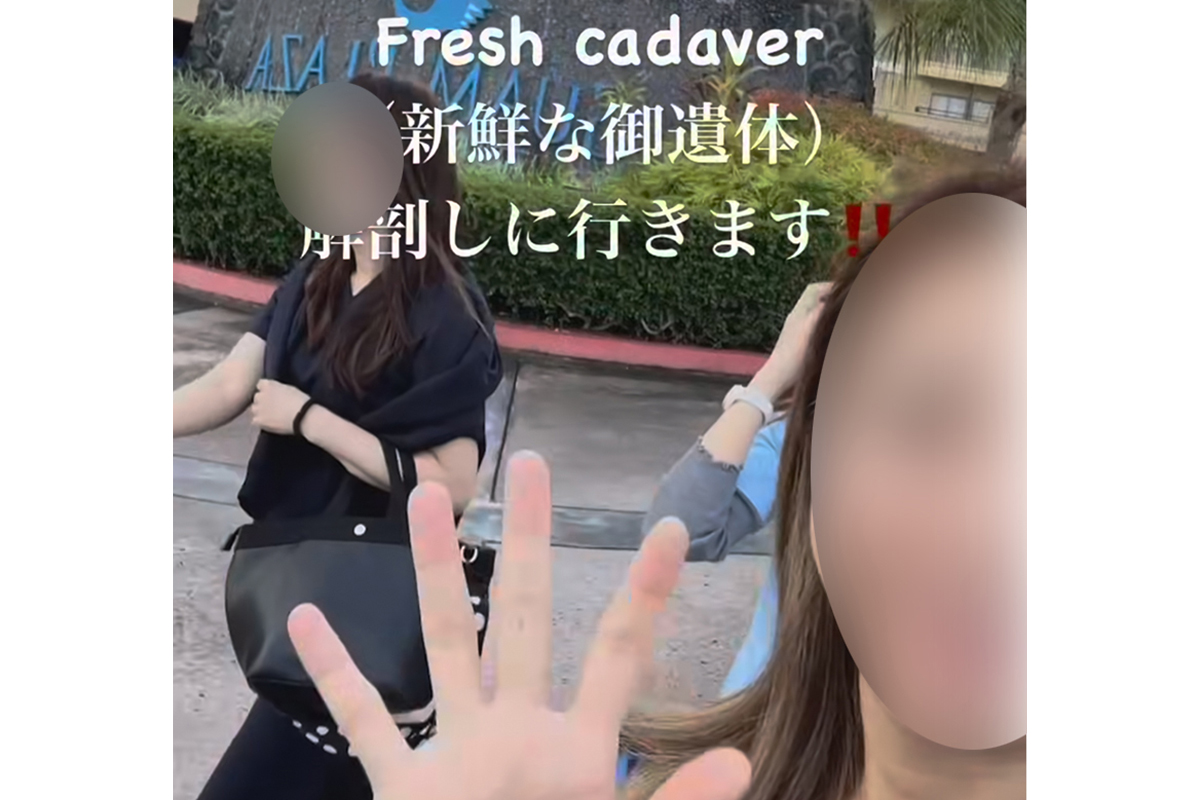 女性　献体　解剖 