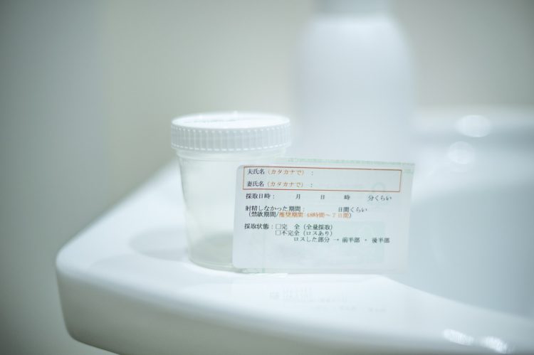 男性の精液検査（イメージ）