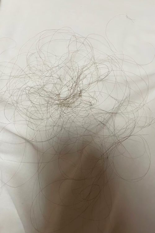 X氏が逆上しむしり取られた髪の毛(写真はAさん提供)