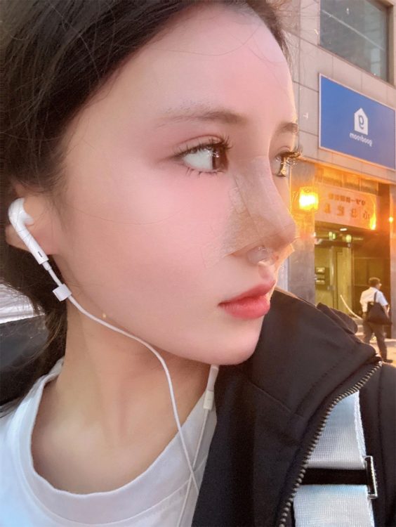 3か月間食事もまともに喉を通らなかったという