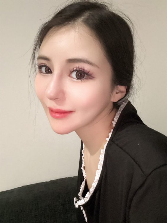 リフトアップ以外はしばらく整形には懲りたという