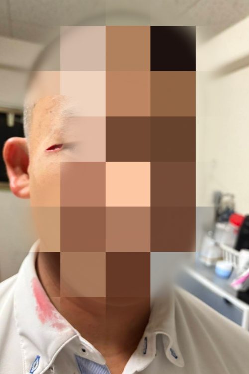 寮生に至近距離からステンレス製のコップを目元に投げつけ暴行していた