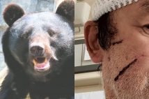 各地でクマの被害が相次いでいる(クマの画像はサンプルです/2023年秋田県でクマに襲われ負傷した男性)
