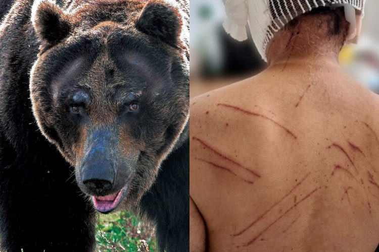 各地でクマの被害が相次いでいる(右は2023年に秋田県でクマに襲われた男性)
