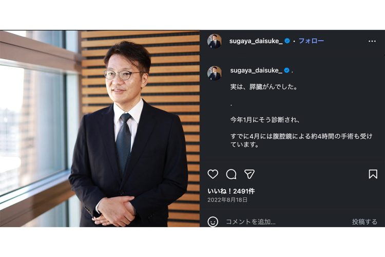 膵臓がんだったことを告白（インスタグラムより）