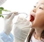 子どもの虫歯予防にシーラントが最近人気の理由
