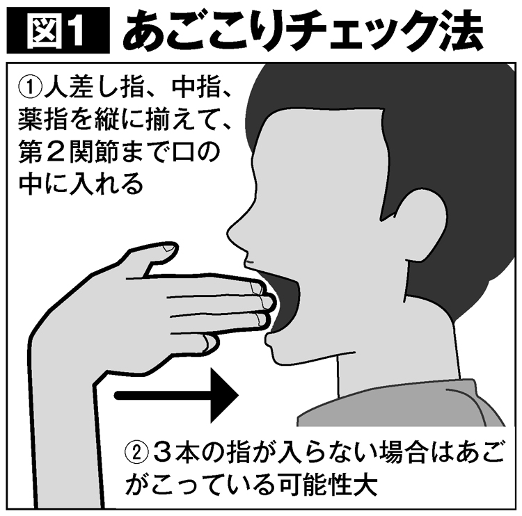 「あごこり」口の中に指3本入らなければ顎関節症の可能性